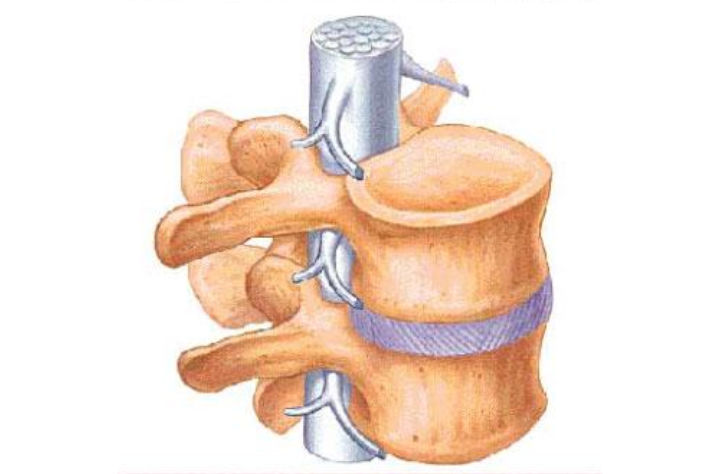 Hernie discale - Tout savoir