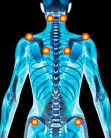 Fibromyalgie : causes et remèdes naturels