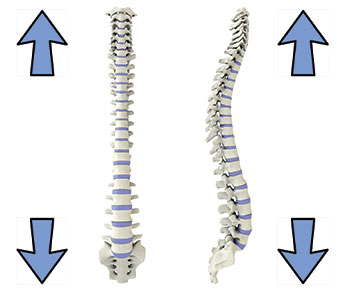 Colonne redressée