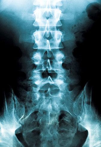 Pathologies soignées Nubax